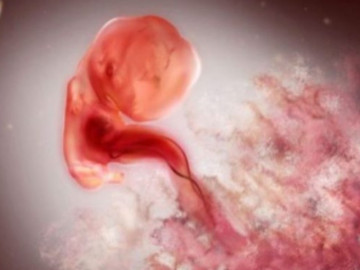 Thai nhi 5 tuần tuổi nhỏ bằng hạt tiêu, mẹ bắt đầu có dấu hiệu mang thai