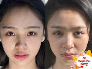 Làm đẹp - Cô gái có màn thay đổi làn da ngoạn mục nhờ đi ngủ, chị em áp dụng ngay để có da đẹp kịp đón Tết