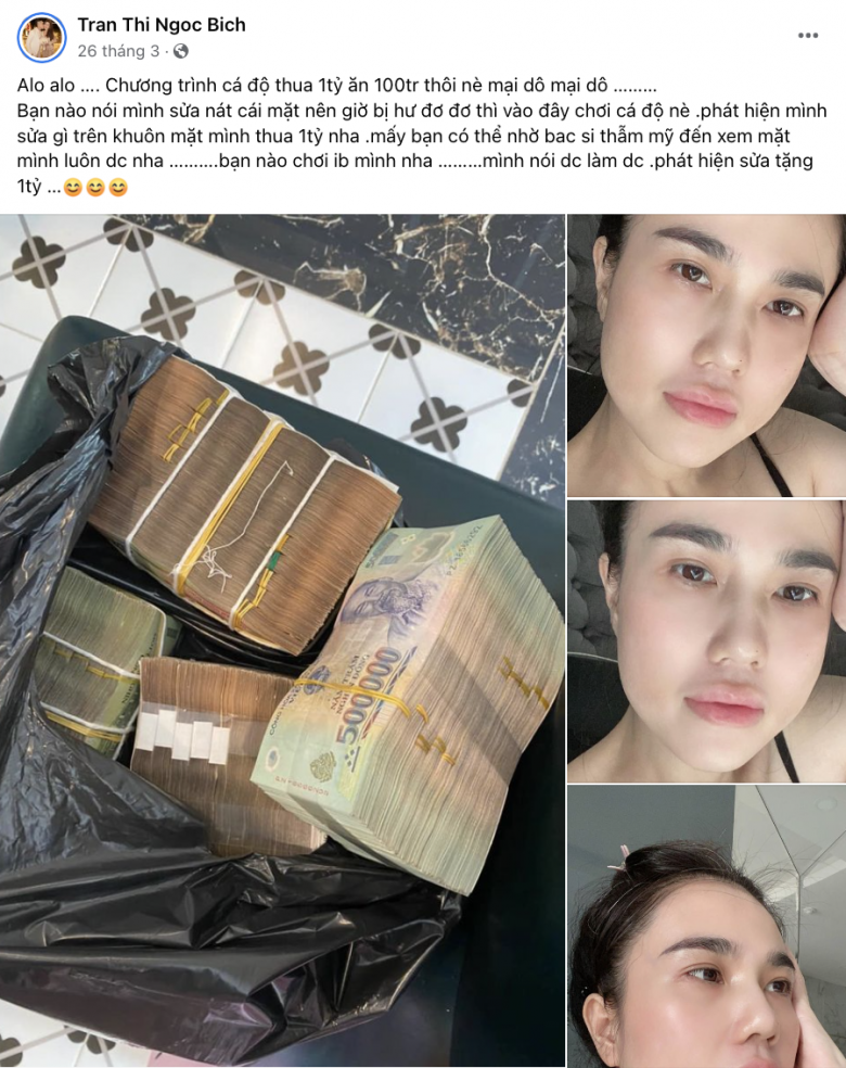 Ngọc Bích khẳng định mình đẹp tự nhiên bằng tuyên bố vô cùng hùng hồn: Phát hiện sửa tặng một tỷ. Điều này đã cho thấy quyết tâm chứng minh bản thân không hề đụng qua dao kéo của bà mẹ ba con.