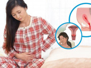 Bà bầu - Sau sinh bao lâu thì hết sản dịch và những dấu hiệu báo động sản phụ cần tái khám gấp