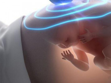 Khi nào mẹ bầu nên thực hiện siêu âm 4D?