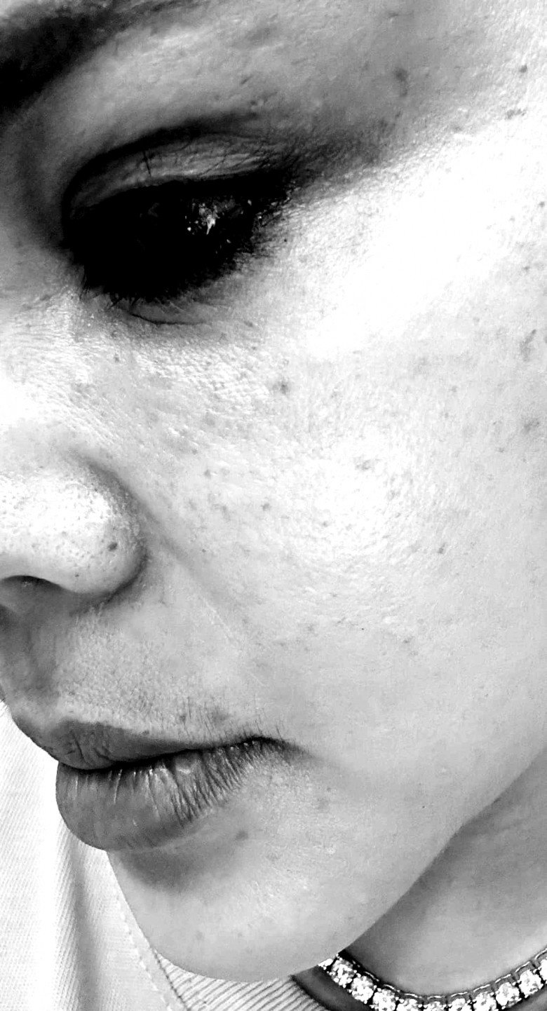 Lê Giang đăng ảnh mới khiến dân tình xót xa, trong đó mắt của nữ diễn viên trông khá đáng sợ.