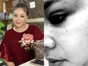 Giải trí - Lê Giang gặp tổn thương nặng buộc phải tạm ngưng công việc, nhìn vào mắt nhiều người sợ hãi