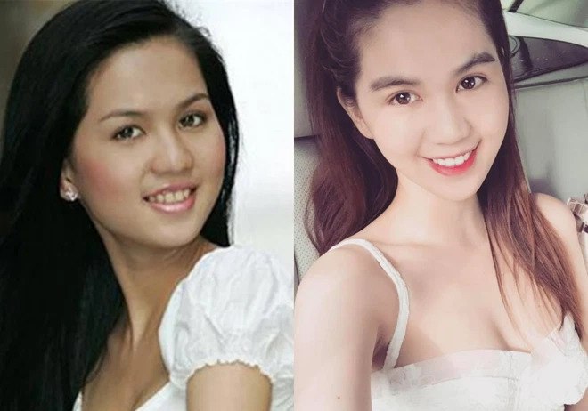 Nữ diễn viên Vòng eo 56 cho biết nhờ niềng răng và phẫu thuật hàm nên không chỉ răng của cô nàng đẹp hơn mà mũi và cằm trông thon gọn trước.