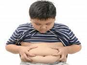 Sức khỏe - Trẻ 10 tuổi nặng 60 kg thì có béo không, liệu có nguy cơ mắc tiểu đường? Nên đi khám ở đâu tốt nhất?