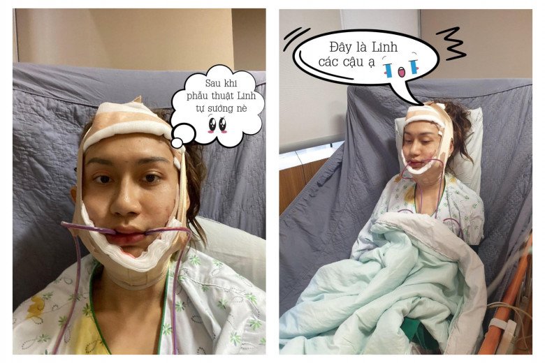 Người đẹp chuyển giới gốc Hà Nội đã trải qua 3 cuộc phẫu thuật để chuyển giới tại Thái Lan tiêu tốn hơn 1 tỷ đồng vào năm 2020.