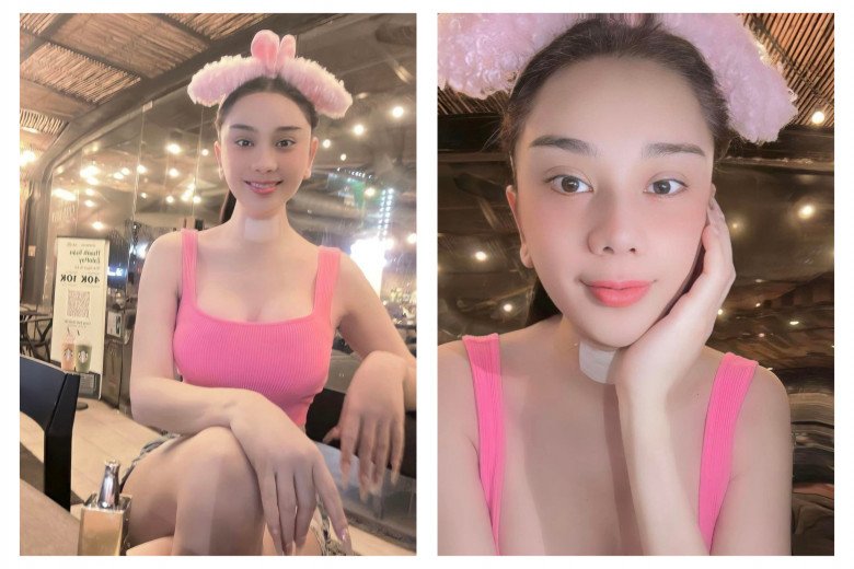 Ngay sau phẫu thuật, người đẹp chuyển giới vẫn giữ được ngoại hình rạng rỡ.