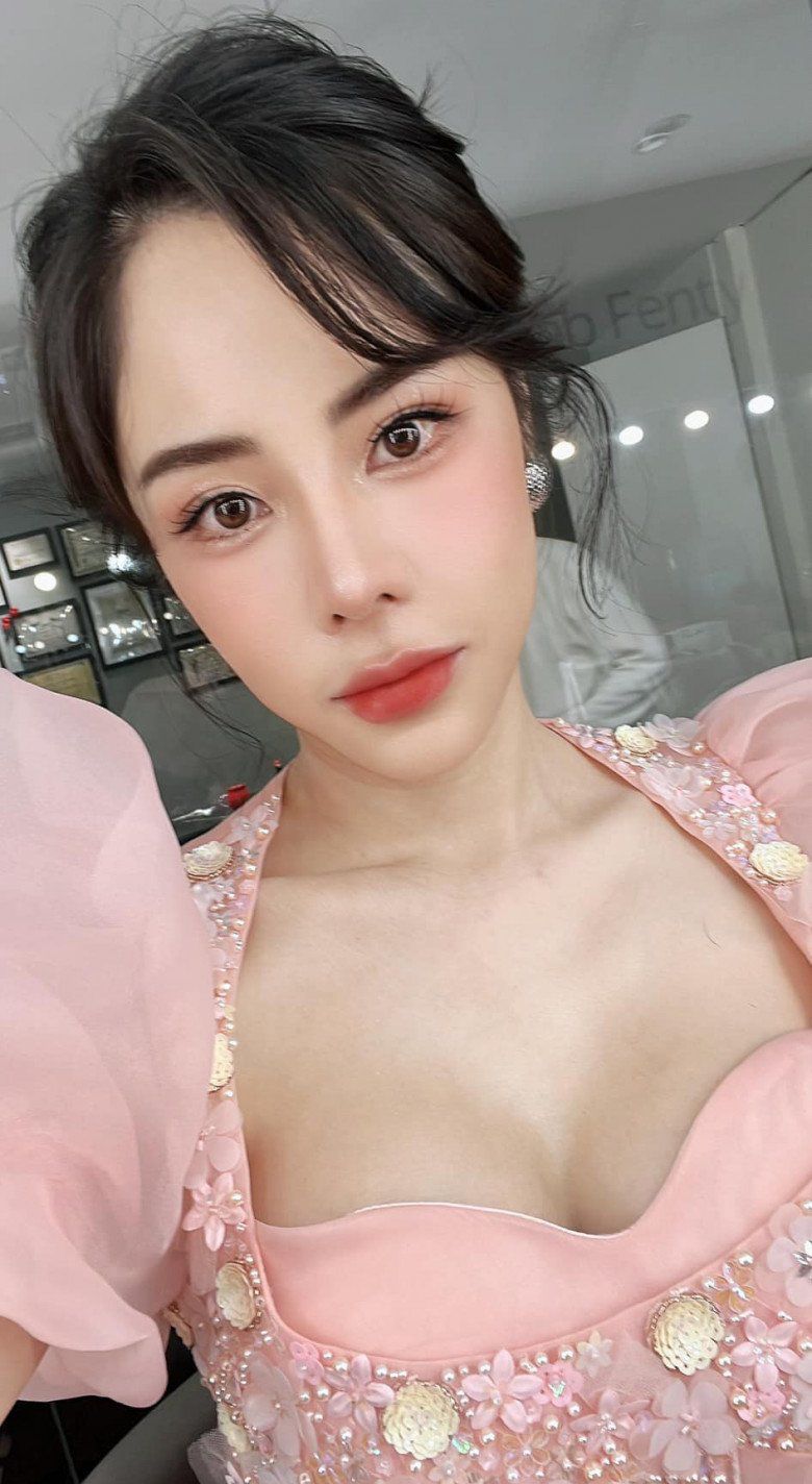 Vì chiếc mũi két này mà bạn gái của Huỳnh Anh bị gán mác nữ hoàng mặt nhựa vì trông gương mặt của cô có phần đơ cứng. 