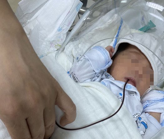 Sau sinh 18 giờ, 2 bé song sinh bất ngờ nôn ra máu, bác sĩ cảnh báo điều mẹ ở cữ phải biết - 1