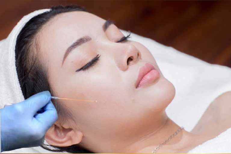 Hậu công khai ảnh cưới, Cát Phượng tái xuất với gương mặt đơ cứng môi tều, dân mạng đoán có tiêm chích nhẹ - 17