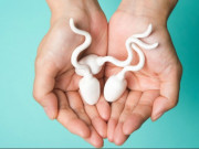 Chuẩn bị mang thai - Tinh dịch vón cục có gây vô sinh?