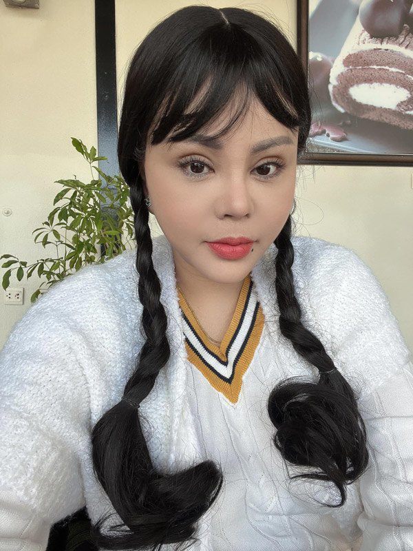 Trong lần cắt mí mắt trước đó vào năm 2021, Lê Giang dù mới dao kéo vài ngày đã phải lên sân khấu. Có thể thấy rõ được dấu vết dao kéo trên mí mắt của cô.