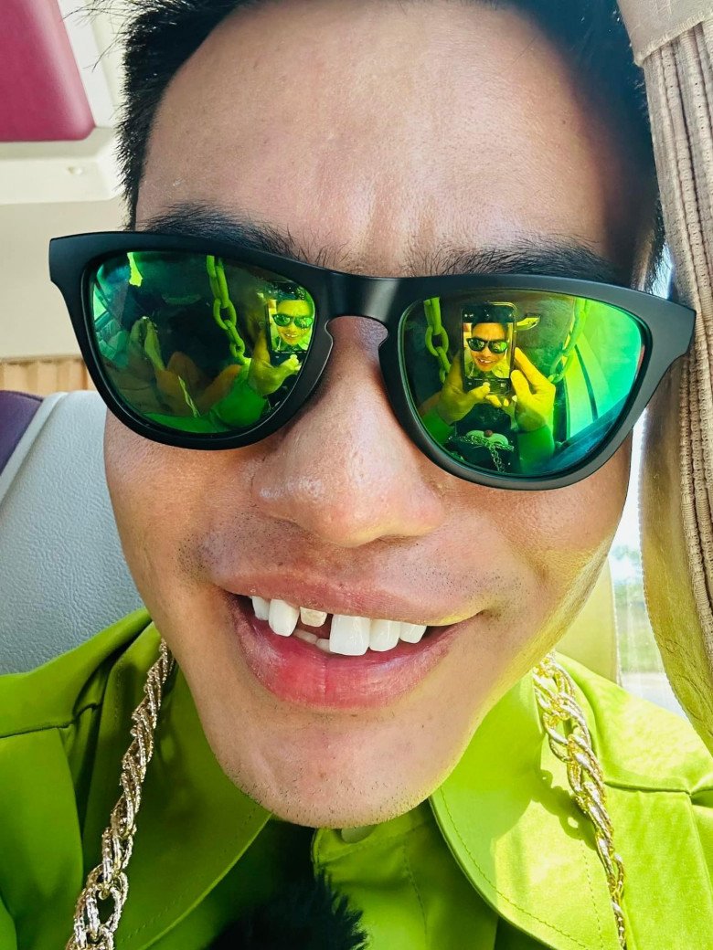 Anh còn đăng tải loạt hình selfie với chiếc răng rụng và bày tỏ: Cái răng đâu phải cái cửa đâu, sơ hở là mở. Mới mở đầu mà xu quá, đây là sự cố chứ không phải miếng hề.