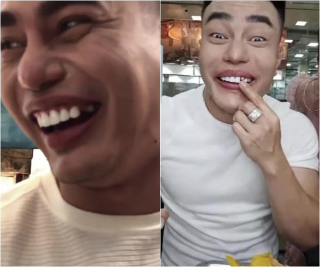 Những lần rớt răng trên sóng của Diệu Lâm.