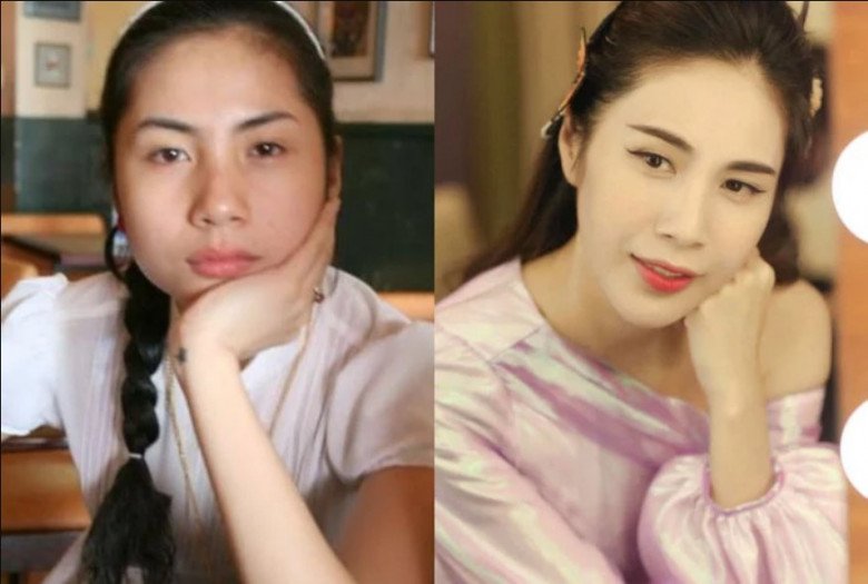 View - Thủy Tiên bị đồn dao kéo, chiếc mũi đổi khác nhưng 1 bộ phận 10 năm không đổi