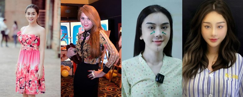 Ròng rã nhiều năm đổ tiền nâng cấp nhan sắc, Lâm Khánh Chi hiện tại đã thay đổi khá nhiều về mặt visual. Mặc dù ý kiến khen chê vẫn đầy rẫy, nhưng bà mẹ đơn thân luôn tự tin với gương mặt của mình.