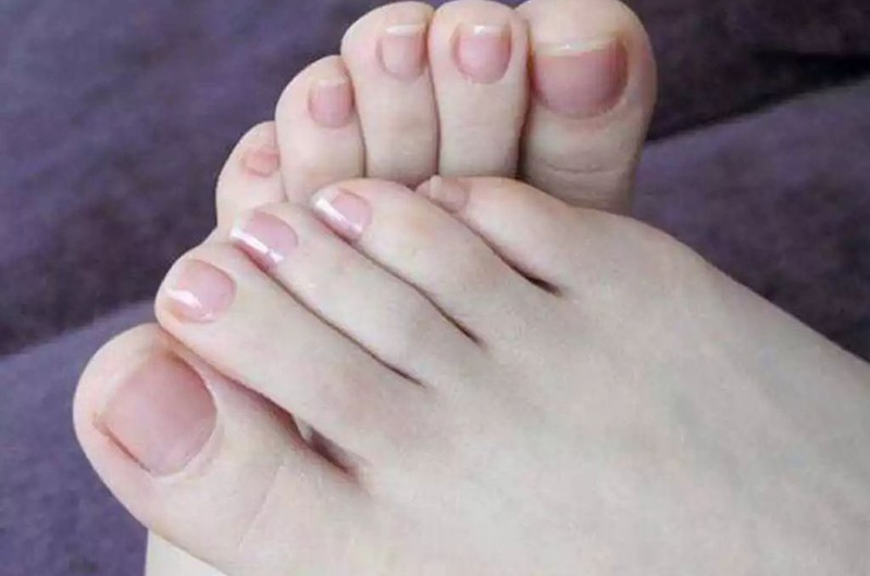 Màu sắc móng tay, móng chân cũng có thể phản ánh tình trạng sức khỏe cũng như tình trạng hấp thụ dinh dưỡng và bài tiết chất độc trong cơ thể. Móng tay, móng chân của người khỏe mạnh sẽ luôn hồng hào, sáng bóng.
