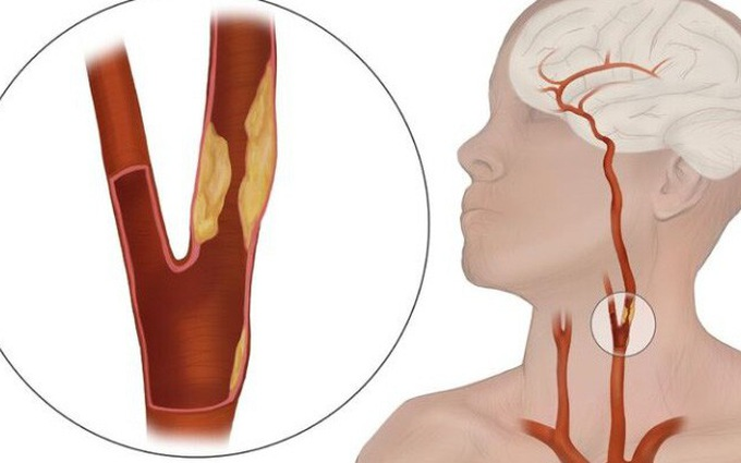 Xoang cảnh là khu vực rất nhạy cảm. (Ảnh minh họa). 