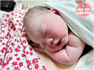 Quyết định quay xe phút chót vào viện Thanh Nhàn mổ đẻ, mẹ bầu có trải nghiệm đáng nhớ