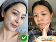 Làm đẹp - Chăm đủ 7749 bước mà da body vẫn sần sùi đen nhẻm, có thể bạn đang phạm sai lầm này!