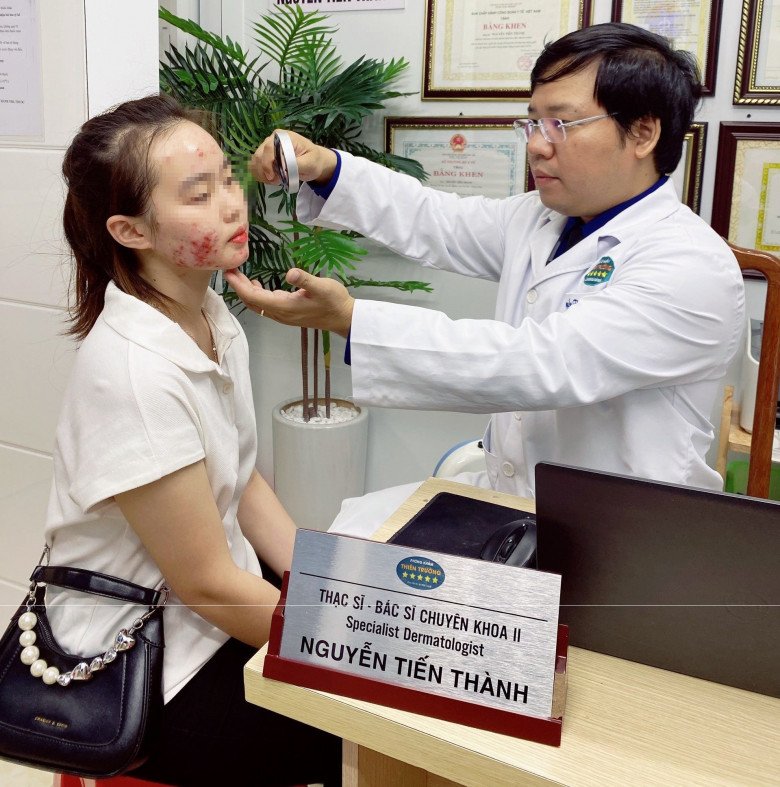 Nhiều bệnh nhân mặt bị tổn thương nặng do dùng các sản phẩm làm đẹp không đảm bảo, không rõ nguồn gốc. Ảnh: BSCC.
