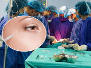 Làm đẹp - Khử thâm mi mắt bằng oxy già tẩy trắng răng, người phụ nữ Hà Giang bị hoại tử mí mắt