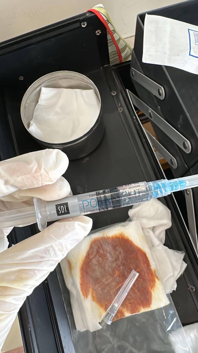 Cận cảnh dung dịch và ống tiêm oxy già được dùng làm tẩy trắng răng được tiêm vào phần rãnh lệ của người phụ nữ Hà Giang.