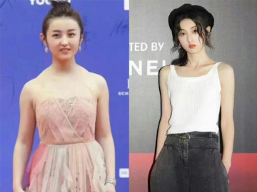 Rộ lên phương pháp phẫu thuật thẩm mỹ 0 đồng, chẳng đau đớn mà gọn mặt thần kỳ