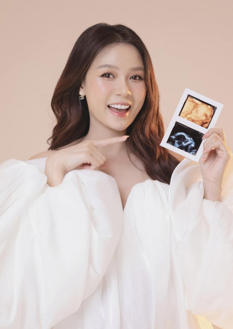 View - Sam xác nhận mang thai con đầu lòng, khoe ảnh siêu âm cuối thai kỳ rõ mặt em bé