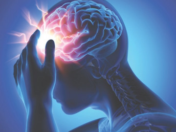 Dùng quá nhiều thuốc tránh thai, cô gái trẻ bị đột quỵ não