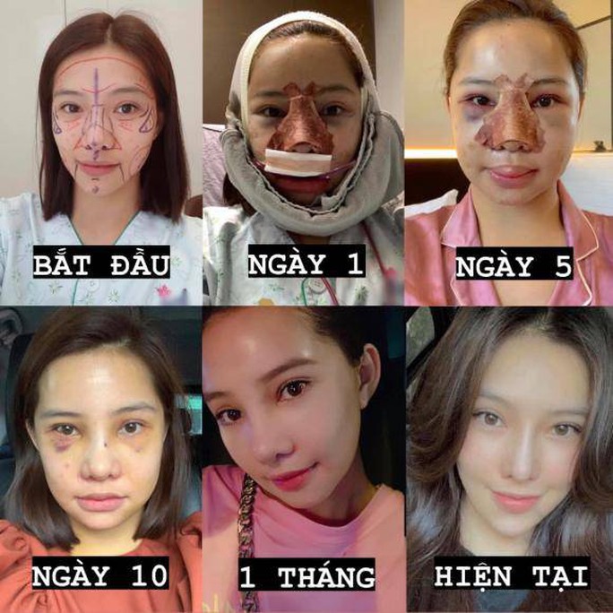 Cô cũng công khai chuyện đập đi xây lại.