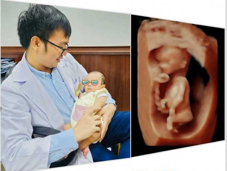 Bác sĩ Võ Tá Sơn - Chuyên gia về y học bào thai. (Ảnh: BSCC)