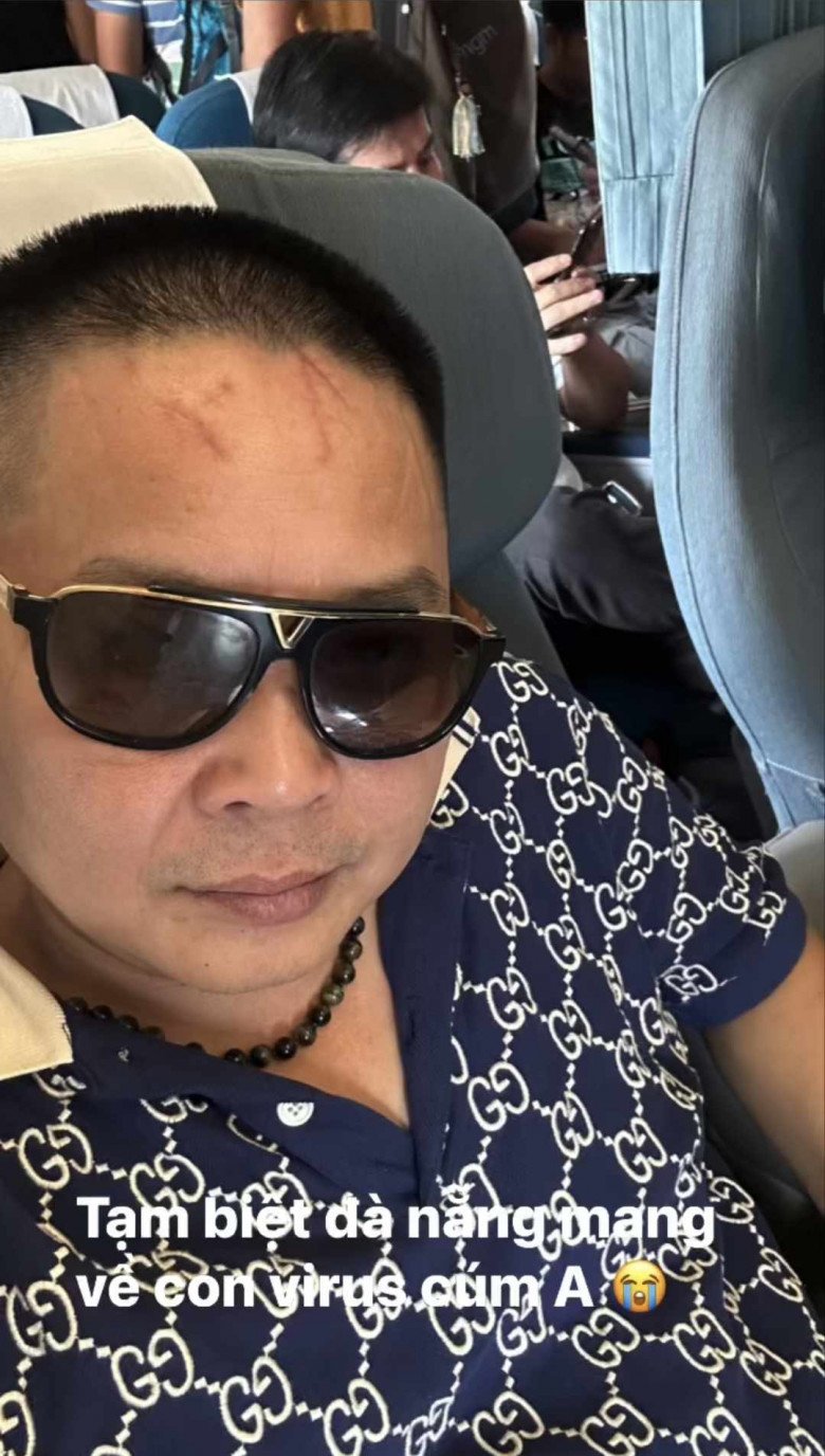Chồng đại gia Phan Lĩnh của ca sĩ Bảo Thy hiếm hoi đăng ảnh selfie, đầu đầy sẹo gây chú ý - 1