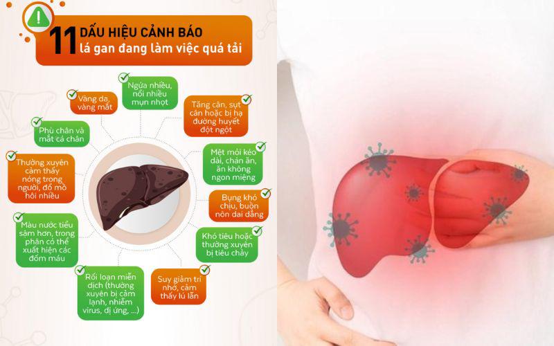 Một số dấu hiệu cho thấy gan cần được giải độc có thể kể đến như vàng da và mắt, cơ thể mệt mỏi, khả năng tập trung kém, nước tiểu đậm màu, tiêu hóa kém, thường xuyên bị đầy hơi, chướng bụng.
