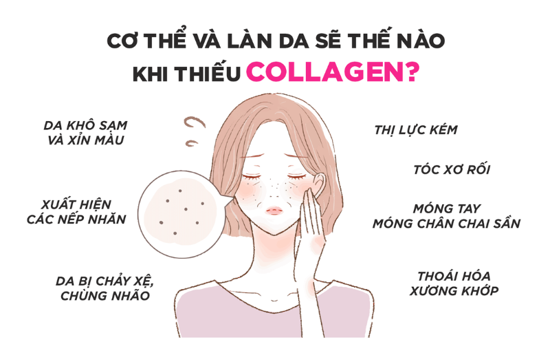 Sự thiếu hụt collagen có thể xuất hiện những biểu hiện được nhìn thấy bằng mắt thường, thông qua việc da thiếu độ đàn hồi, khô và xuất hiện các nếp nhăn, xương khớp mất đi sự dẻo dai,...
