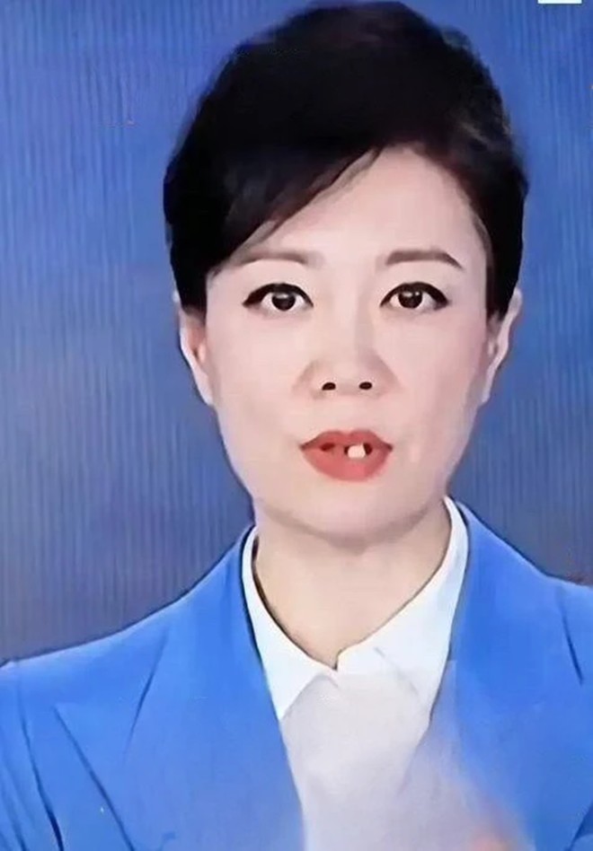 Nữ BTV có gương mặt y hệt Vũ Hà bị rơi răng, người anh dẫn cùng Phan Như Thảo vừa gặp sự cố tương tự - 3