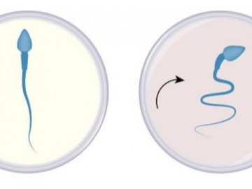 Nam giới rối loạn cương dương, chậm có con cần biết điều này