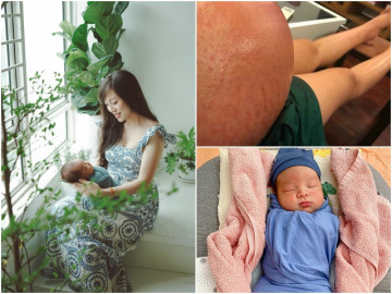 Mẹ bầu ham ăn hải sản bị ngộ độc thai kỳ chưa từng có tiền lệ tại viện, sau sinh điều kỳ diệu đã xảy ra