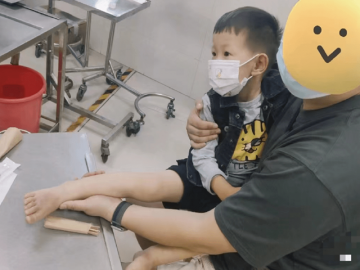 Con bị bỏng mẹ chưa bế đi viện mà đổ thêm 1 thứ lên khiến bà nội tức giận, bác sĩ tấm tắc khen