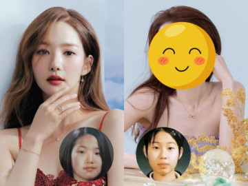 Đệ nhất mỹ nhân dao kéo Hàn Quốc: Park Min Young không là duy nhất