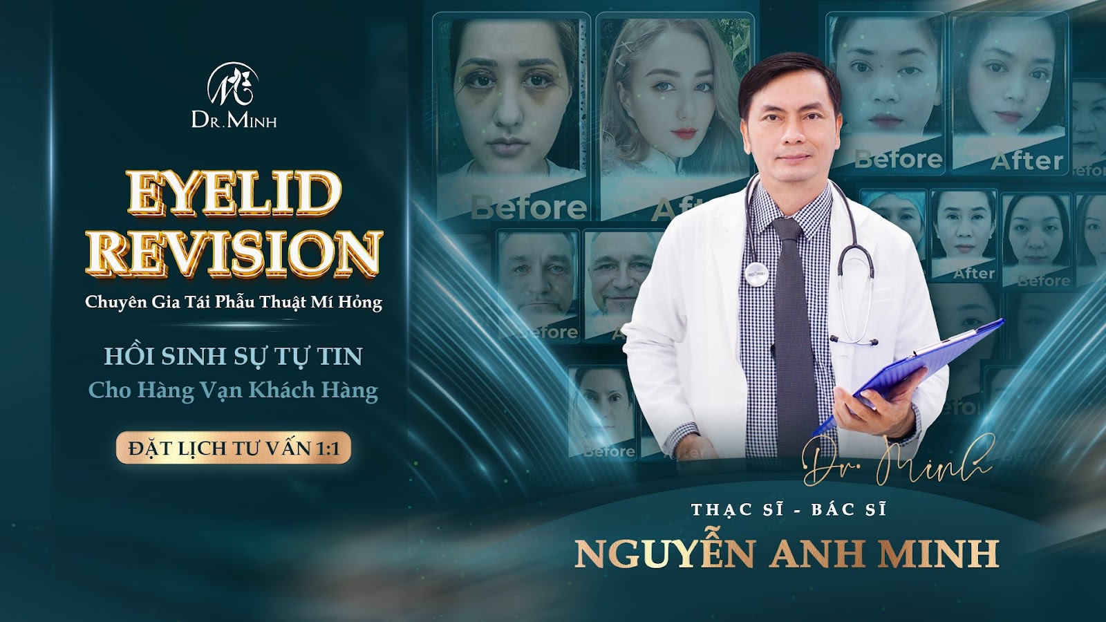 Dr. Minh - Chuyên gia tái phẫu thuật mí: Hồi sinh đôi mắt, hồi sinh tự tin! - 1