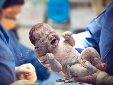 Chứng kiến hành trình chào đời của em bé qua ống kính nhiếp ảnh gia