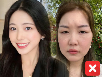 8 thói quen khiến phụ nữ mãi chẳng đẹp, tệ nhất còn gây lệch mặt, xô răng