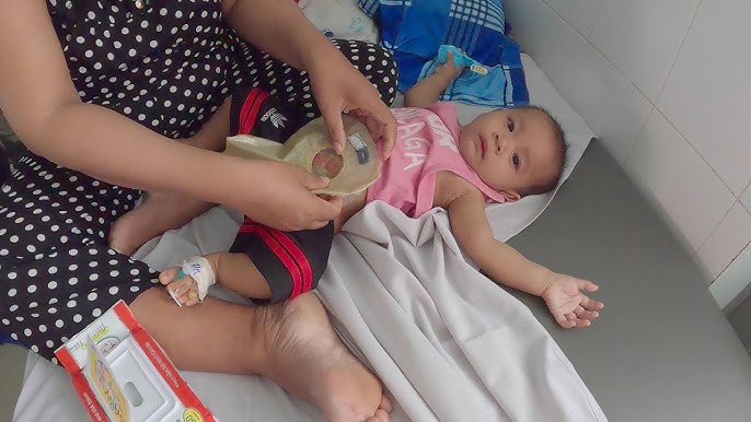 Hiện tại bé Bình An đã trải qua cuộc phẫu thuật lần 1 - tạo hình hậu môn.