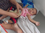 Tin tức - Người mẹ ngã gục khi con gái Bình An vừa chào đời đã không có hậu môn, ai biết rõ hoàn cảnh cũng xót xa