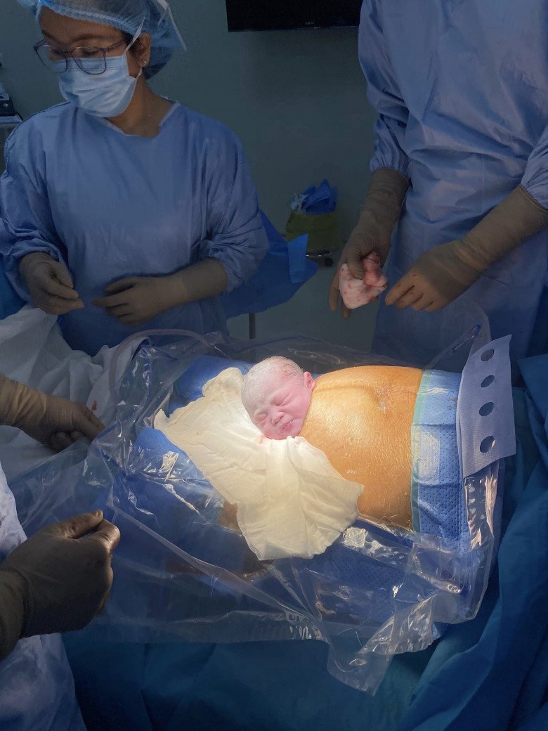 Em bé sinh ra nhẹ cân nhưng khỏe mạnh, an toàn nhờ theo dõi dây rốn bám màng sát sao. (Ảnh: BSCC)