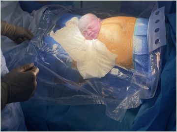 Sau cưới vợ trẻ đi khám phát hiện dự trữ buồng trứng giảm, chồng cũng bất ngờ vì bị bệnh này