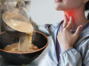 Người phụ nữ mắc ung thư thực quản vì một việc hay làm vào mùa đông đã được WHO cảnh báo từ lâu