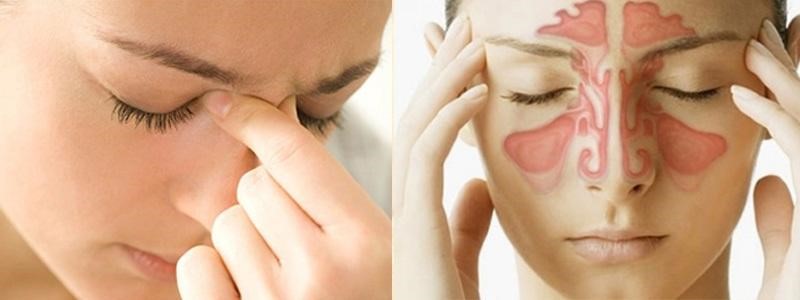 Đau hốc mắt - một trong những biến chứng viêm xoang điển hình