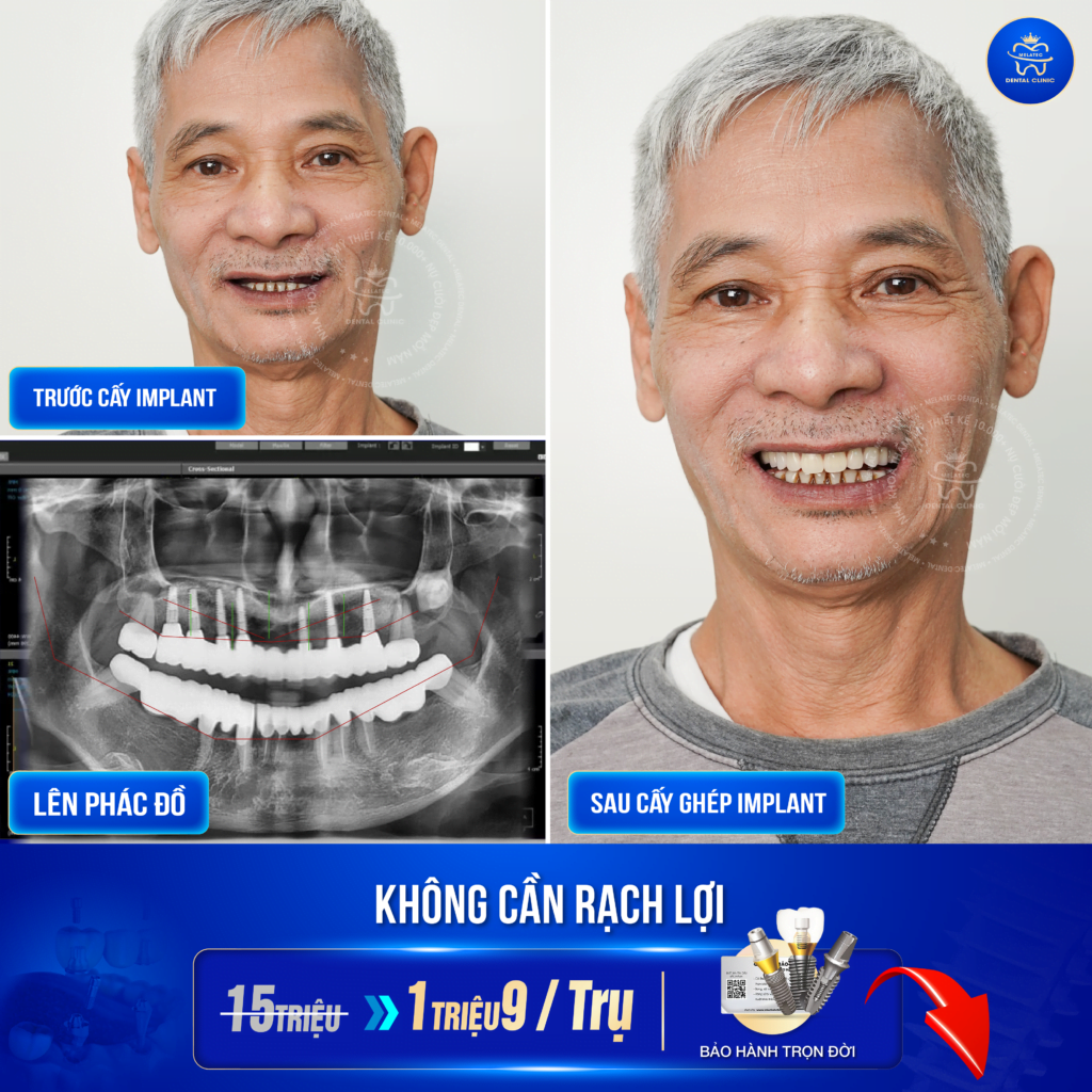 Nha Khoa Melatec - Điểm đến Tin Cậy Cho Nụ Cười Người Việt